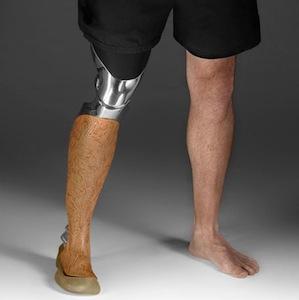 Custom Designed Prosthetic Legs