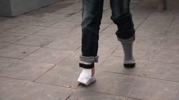 Outdoor Slippers For Disabled Feet